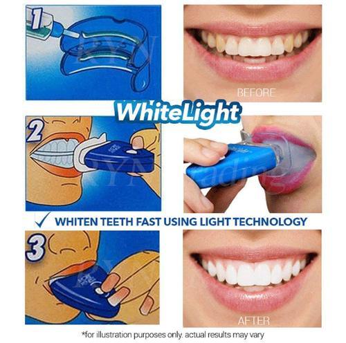 White Light Teeth Whitening Brightener